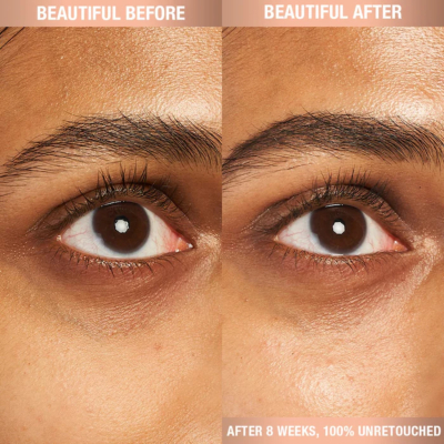 Крем для кожи вокруг глаз Charlotte Tilbury Magic Eye Rescue Cream 15 ml